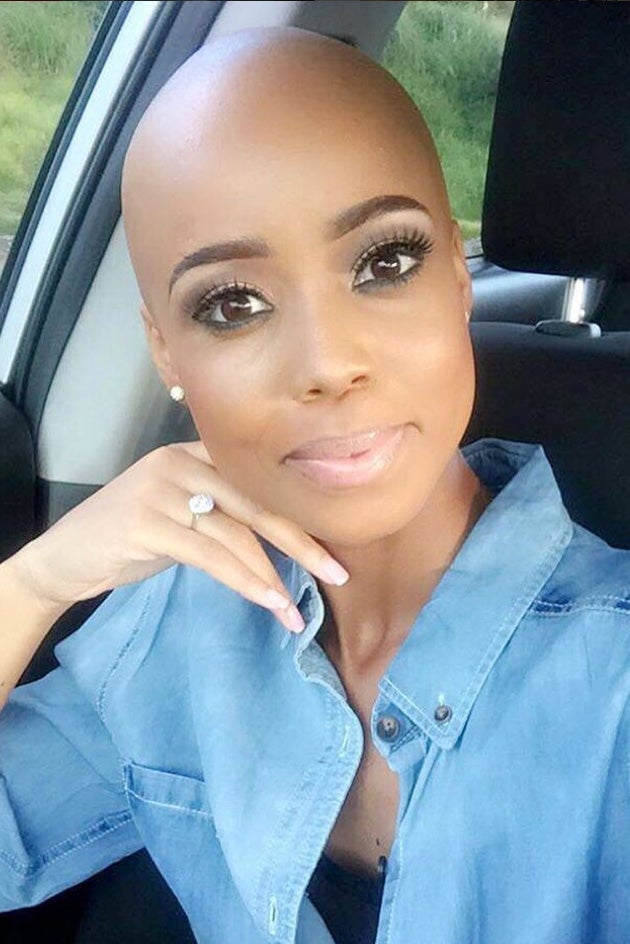 19 Stunning Black Women Whose Bald Heads Will Leave You Speechless